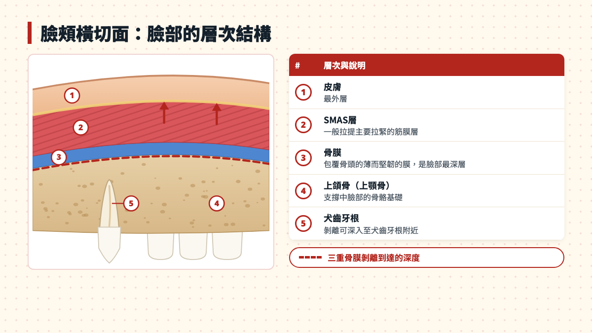 臉頰橫切面圖:皮膚、SMAS層、骨膜、上頜骨與犬齒牙根
